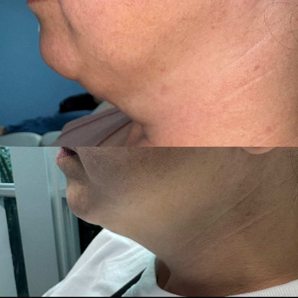 Drip Health & MedSpa | Aesthetics • Wellness • Men’s Health | Miami Lakes